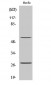 CD69 Polyclonal Antibody