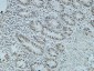 Cdc25B Polyclonal Antibody