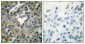 Cdc25B Polyclonal Antibody