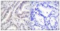 Cdc6 Polyclonal Antibody