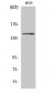 c-Fms Polyclonal Antibody