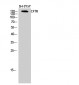 CFTR Polyclonal Antibody