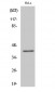 ChemR23 Polyclonal Antibody