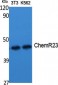 ChemR23 Polyclonal Antibody