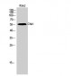 Chk1 Polyclonal Antibody