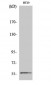 Chk1 Polyclonal Antibody