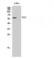 Chk2 Polyclonal Antibody