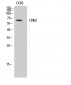 Chk2 Polyclonal Antibody