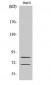 Choactase Polyclonal Antibody