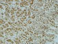 c-Myc Polyclonal Antibody