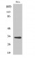 CNOT7 Polyclonal Antibody