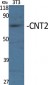 CNT2 Polyclonal Antibody