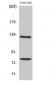 COL1A2 Polyclonal Antibody