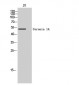 Coronin 1A Polyclonal Antibody