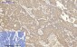 Cox-2 Polyclonal Antibody