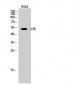 CPE Polyclonal Antibody