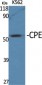 CPE Polyclonal Antibody