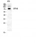 CPTI-M Polyclonal Antibody