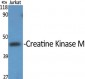 Creatine Kinase M Polyclonal Antibody