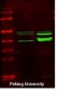 Creatine Kinase M Polyclonal Antibody