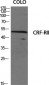 CRF-RII Polyclonal Antibody