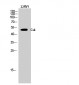 Csk Polyclonal Antibody