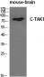 C-TAK1 Polyclonal Antibody