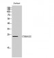 CYB561D2 Polyclonal Antibody