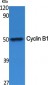 Cyclin B1 Polyclonal Antibody