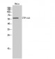 CYP11A1 Polyclonal Antibody