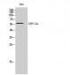 CYP17A1 Polyclonal Antibody