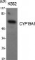 CYP19A1 Polyclonal Antibody