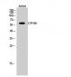 CYP1B1 Polyclonal Antibody