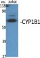 CYP1B1 Polyclonal Antibody