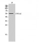 CYP21A2 Polyclonal Antibody