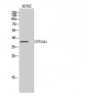 CYP24A1 Polyclonal Antibody