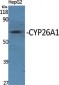 CYP26A1 Polyclonal Antibody