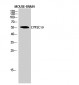 CYP2C19 Polyclonal Antibody