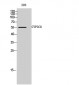 CYP2C8 Polyclonal Antibody