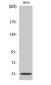 CYP2D6 Polyclonal Antibody