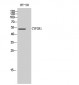 CYP2R1 Polyclonal Antibody