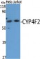 CYP4F2 Polyclonal Antibody