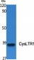 CysLTR1 Polyclonal Antibody