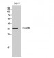 CysLTR1 Polyclonal Antibody