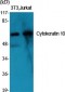 Cytokeratin 10 Polyclonal Antibody