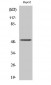 Cytokeratin 13 Polyclonal Antibody