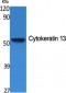 Cytokeratin 13 Polyclonal Antibody