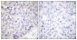 Cytokeratin 18 Polyclonal Antibody