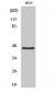 Cytokeratin 18 Polyclonal Antibody