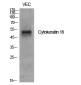 Cytokeratin 18 Polyclonal Antibody